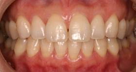 �z���C�g�j���O��