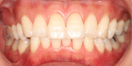 �z���C�g�j���O��