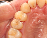 �ނ�������菜�����Ƃ���