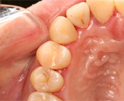 �R���|�W�b�g���W�����߂āA�ނ����̏��u���I�������Ƃ���