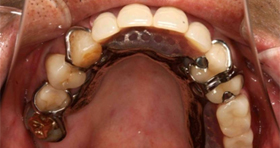 �������`�����A�����̒��ɓ��ꂽ�ʐ^