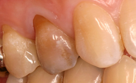 �n�C�u���b�h�Z���~�b�N�X��