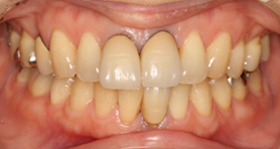 �I�[���Z���~�b�N�X�N���E���O