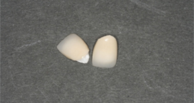 �I�[���Z���~�b�N�X�N���E��