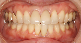 ���̌�A�����O�����C�ɂȂ�Ƃ̂��ƂŃZ�������^���N���E����蒼���܂����B