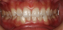 �z���C�g�j���O�@�Q�T�Ԍ�